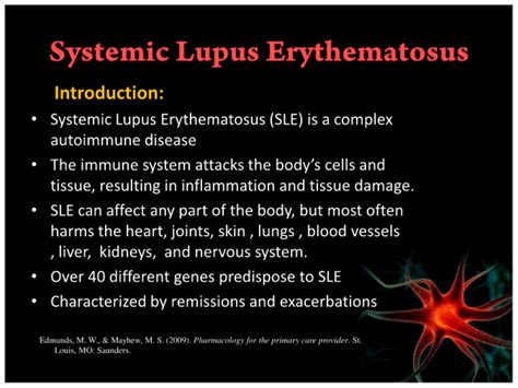 Systemic Lupus