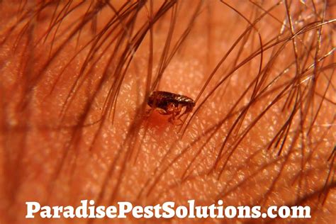 Can Fleas Live In Human Hair