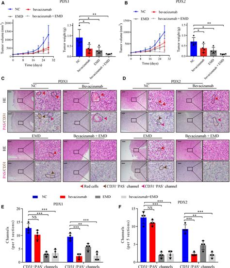 Synergistic Effect Of EMD And Bevacizumab In CRC PDX Models A B