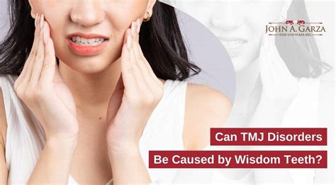 Can Tmj Disorders Be Caused By Wisdom Teeth John A Garza Dds Lvif