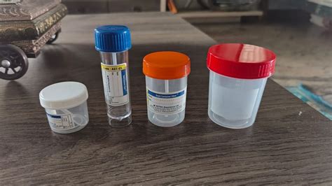 Plastic Urine Stool Specimen Container For Chemical Laboratory