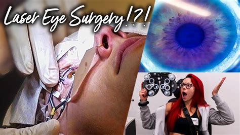 What Its Like To Get Laser Eye Surgery Lasik Youtube