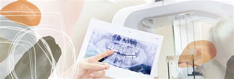 CBCT Dental Imaging in Oakville at Palermo Village Dental