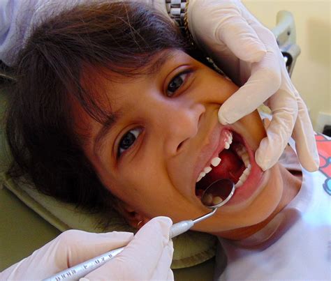 Dentes De Leite Merecem Aten O Rc Odontologia Especializada