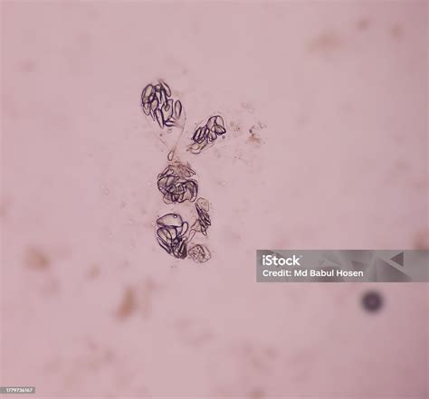 Giardia Lamblia Cysts And Trophozoite Form Muscle Fiber In Stool Examination Under 40x Light