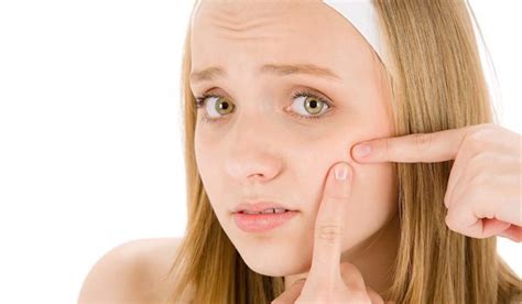 Types Of Acne And What It Reveals About Your Overall Well Being