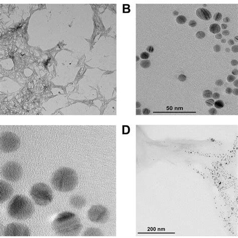 Tem Diagram Of A Cncs B And C Cp Agnps Illustration Cp Agnps