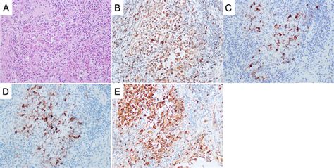 Pathological examination images. A hematoxylin–eosin (H & E) staining ...