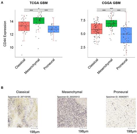 Cd Expression In Gbm Subtypes A Cd Is Highly Upregulated In