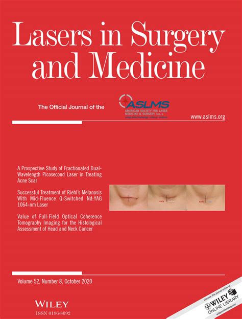 Co2 Laser Punch‐assisted Minimally Invasive Surgery For Sebaceous Cysts