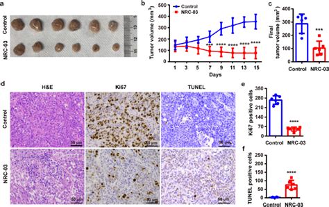 Nrc Inhibited Tumor Growth In The Ectopic Tumor Model Of Oscc