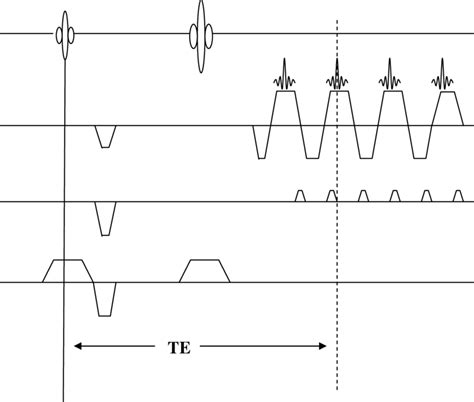 Pulse Sequence Diagram For A Single Shot Se Epi Sequence Download