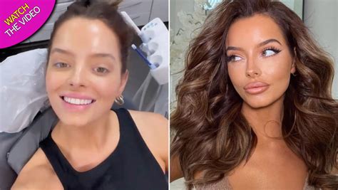 Love Islands Maura Higgins Shows Off New Teeth After Getting Braces