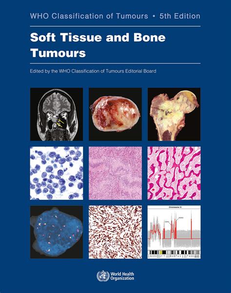 Who Classification Of Tumours 5th Ed Vol5 Thoracic Tumours 洋書／南江堂