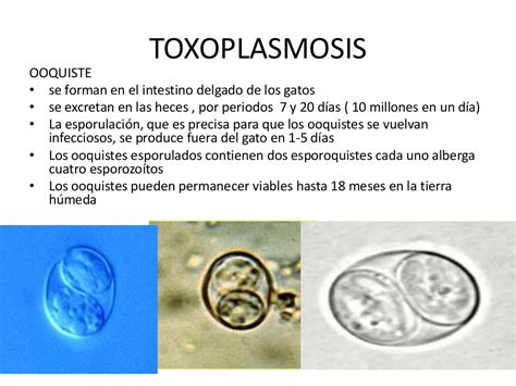 Toxoplasmosis.