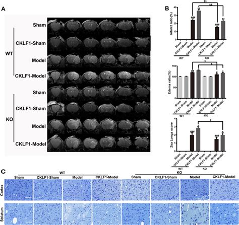 Knock Out Of CKLF1 Decreases Brain Damage And Supplement With CKLF1