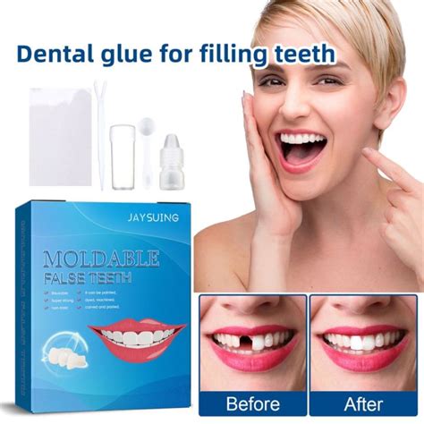 Temporary Tooth Repair Kit False Teeth Solid Glue Denture For Missing Broken Teeth Moldable