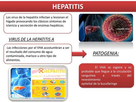 Hepatitis Res Menes Medicos Udocz