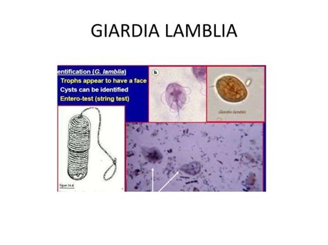 Free Living Amebae Naegleria Fowleri Acanthamoeba Balamuthia Mandrillaris Trichomonas