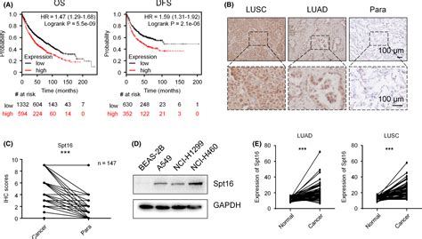 Suppressor Of Ty 16 Promotes Lung Cancer Malignancy And Is Negatively