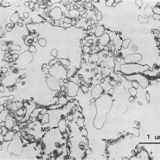 Freeze Fracture Electron Micrograph Of Liver Plasma Membrane