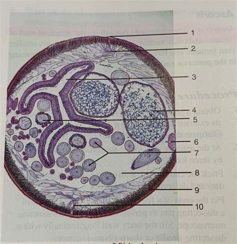 Female Ascaris Diagram Quizlet