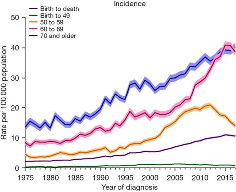 Hcc Intrahepatic Cholangiocarcinoma Cases Increase Dramatically In Us Us Medicine