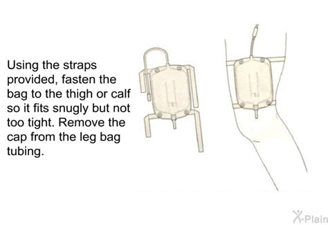 PatEdu.com : Nephrostomy Tube Care