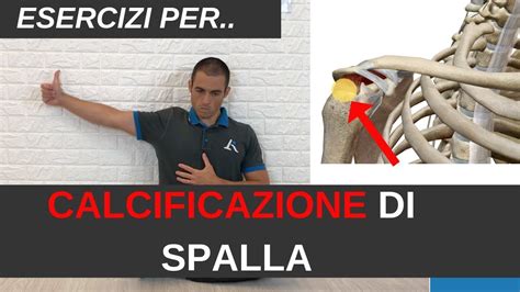 Hai Una CALCIFICAZIONE ALLA SPALLA Prova I 3 ESERCIZI MIRATI YouTube