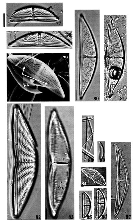 Amphora Taxa Sem Scale Bar Fig 79 5 Pm Fig 84 10 Pm Lm Scale