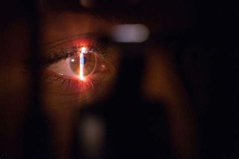 Cómo Reconocer El Glaucoma La Enfermedad Que Causa Ceguera La Tercera