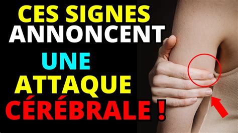 Les 5 Signes Avant Coureurs D Un AVC Un Mois Avant Accident