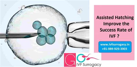 Laser Assisted Hatching In India Go Ivf Surrrogacy