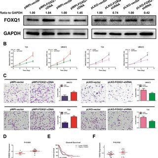 FOXQ1 Promotes BCa Cell Proliferation And Invasion A Verification Of