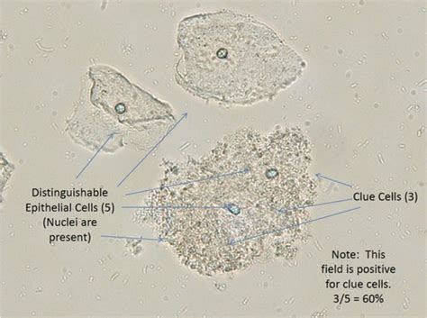 Clue Cells