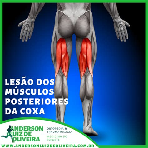 Estiramento Muscular o que é e como tratar