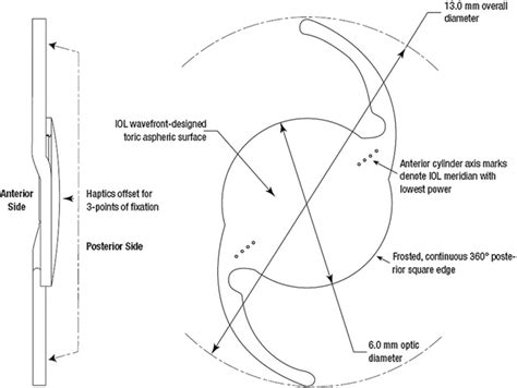 Figure 1 From Clinical Outcomes After Implantation Of A New Hydrophobic Acrylic Toric Iol During