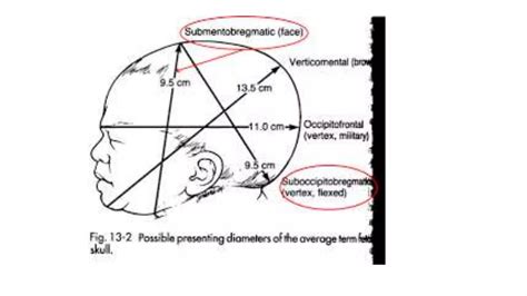 Fetal Skull And Maternal Pelvis Ppt