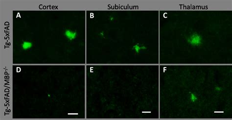 Immunolabeling of brain Aβ deposits in young Tg 5xFAD and bigenic