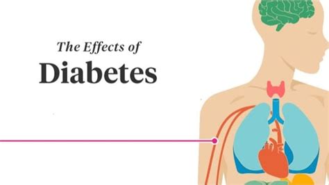 Effects Of Diabetes On Your Body Sugar Fit