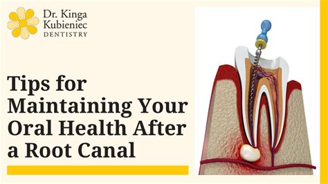 PPT Essential Oral Health Care Practices After A Root Canal