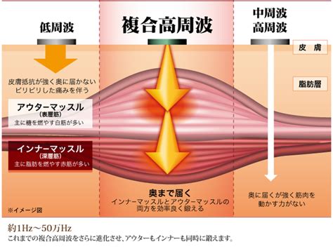 最も好ましい 複合高周波ems 308842