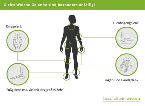 Gicht Symptome Diagnose Behandlung