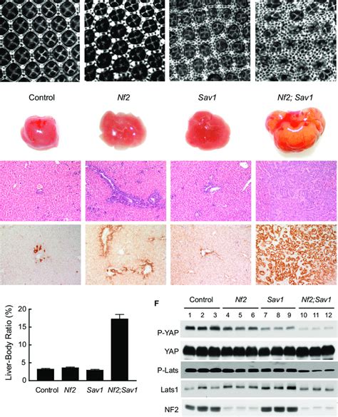 Loss Of Mer Nf And Sav Sav Leads To Synergistic Defects In Hippo