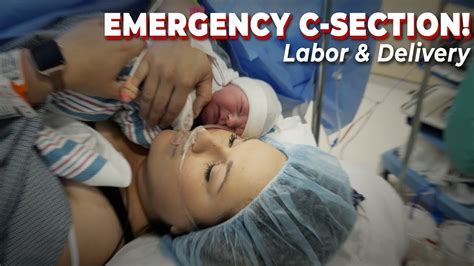 Natural Delivery Turned Emergency C Section Birth Vlog 2021 Youtube