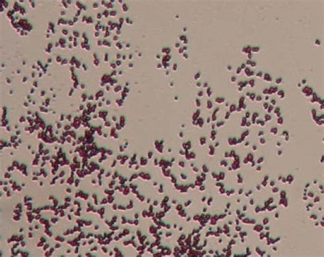 Morphology Of Lactic Acid Bacteria Samples 1000x Magnification