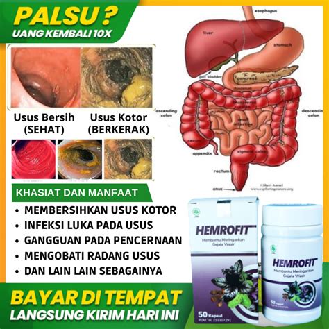 Jual Obat Pembersih Usus Kotor Paling Ampuh Detoxtifikasi Usus Robek