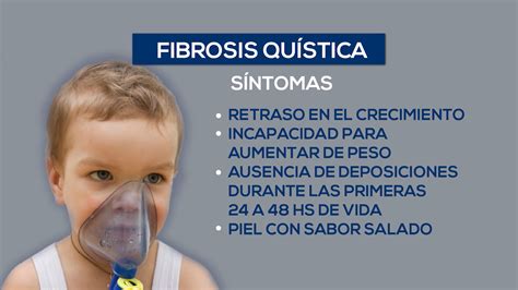 Día Mundial De La Fibrosis Quística Cómo Lograr Un Diagnóstico Temprano Canal 9 Televida Mendoza