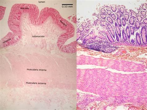 A Histology Tour Of The Gi Tract The Ileum