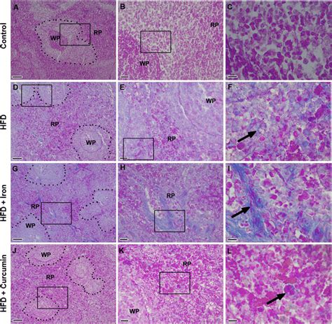 Photomicrographs Of Sections Of Spleen Stained With Masson’s Trichrome Download Scientific